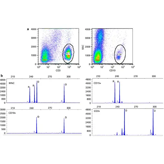 chimerism split cell analysis- myeloid cell (cd15) test